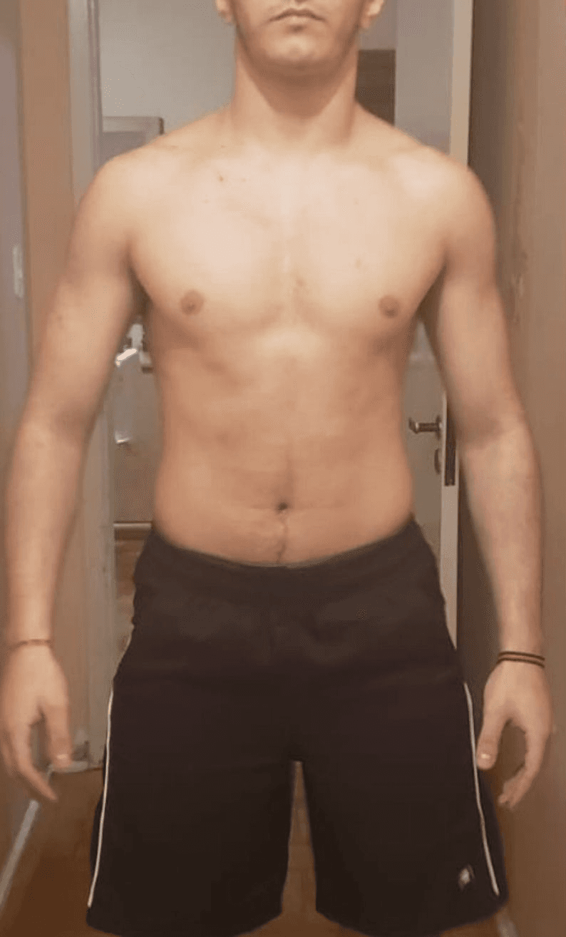 Antes
